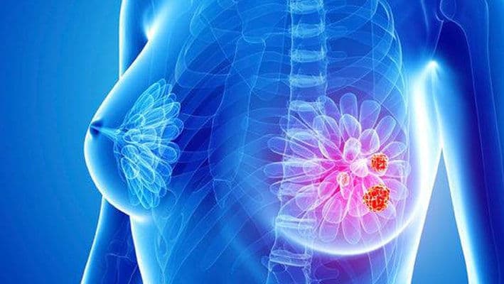 Spania a raportat 111 cazuri de cancer rar legate de implanturile mamare